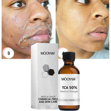 Load image into Gallery viewer, 50%TCA Chemical Peel Anti Aging Anti Wrinkle Peeling Serum for Repair