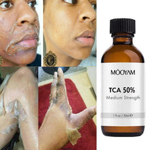 Load image into Gallery viewer, 50%TCA Chemical Peel Anti Aging Anti Wrinkle Peeling Serum for Repair