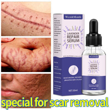 Load image into Gallery viewer, Acne Scar Removal Serum Stretch Marks Treatment Pimples Acne Spots