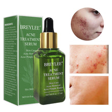 Load image into Gallery viewer, Acne Treatment Essence Tea Tree Oil Clear Skin Essence for Clearing - Sophornlilly