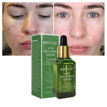 Load image into Gallery viewer, Acne Treatment Essence Tea Tree Oil Clear Skin Essence for Clearing - Sophornlilly