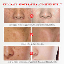 Load image into Gallery viewer, EFERO Face Cream Whitening Freckles Remove Anti Age Black Spots Skin