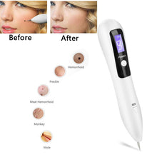 Load image into Gallery viewer, LED Lighting Plasma Pen Remove Freckles Tattoo Facial Treatment Remove