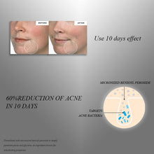 Load image into Gallery viewer, La Roche Posay Effaclar Duo/k+ Facial Acne Treatment Gel B5 Repair