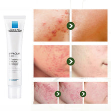 Load image into Gallery viewer, La Roche Posay Effaclar Duo/k+ Facial Acne Treatment Gel B5 Repair