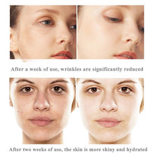 Load image into Gallery viewer, Mini Ultrasonic RF Face Lifting Beauty Device Wrinkle Removal Skin