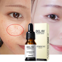 Load image into Gallery viewer, Retinol Facial Serum Anti Wrinkle Remove Dark Spots Face Essence