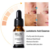 Load image into Gallery viewer, Retinol Facial Serum Anti Wrinkle Remove Dark Spots Face Essence