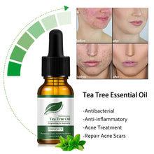 Load image into Gallery viewer, Retinol Facial Serum Anti Wrinkle Remove Dark Spots Face Essence